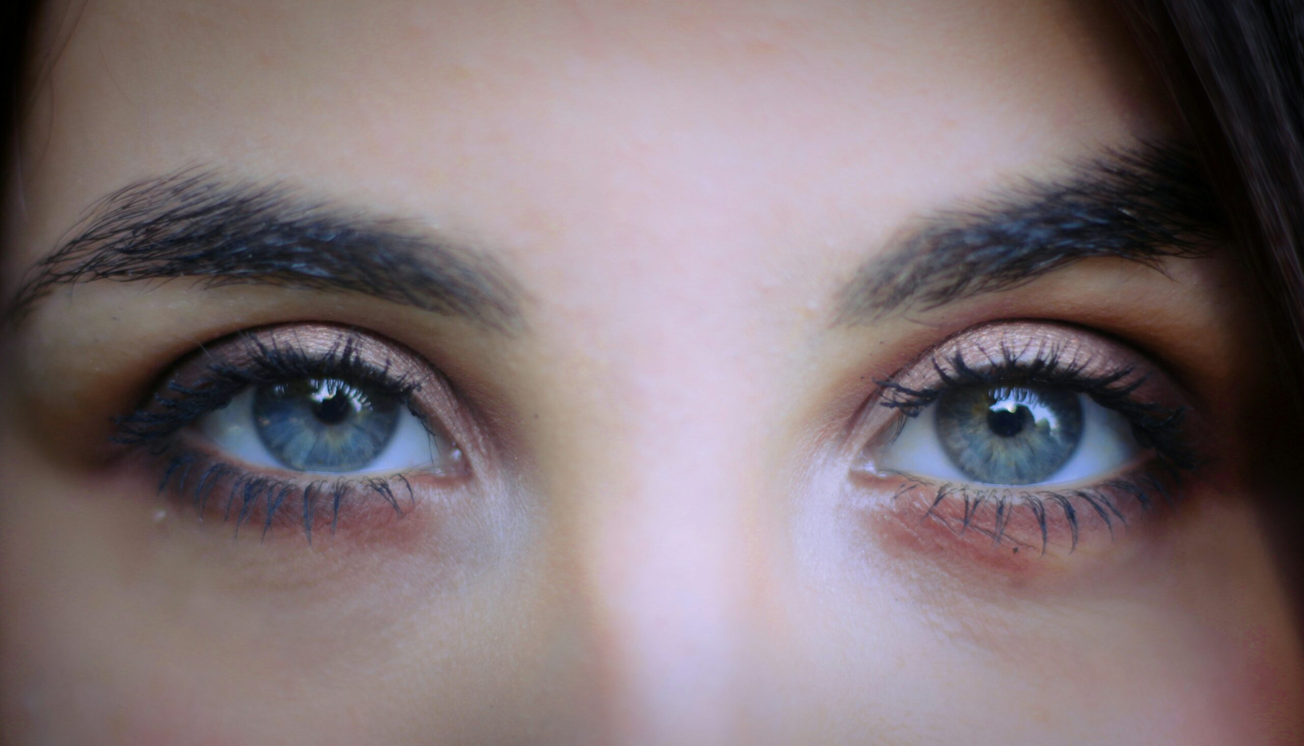 Grains de milium ou syringomes autour des yeux – Dr Pierunek Paris 7