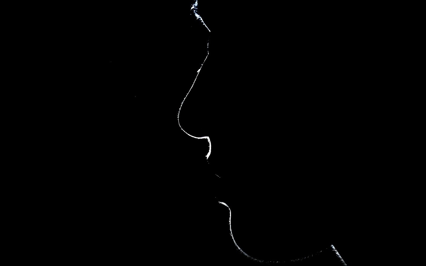 Rhinoplastie médicale – Dr Pierunek Paris 7 Rhinoplastie médicale : examen du profil du nez en consultation à Paris 7
