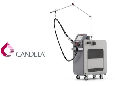 GentleMax Pro (CANDELA) , laser vasculaire et épilatoire